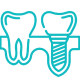 Endodontic (Root Cana2