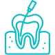Endodontic (Root Canal) Treatment